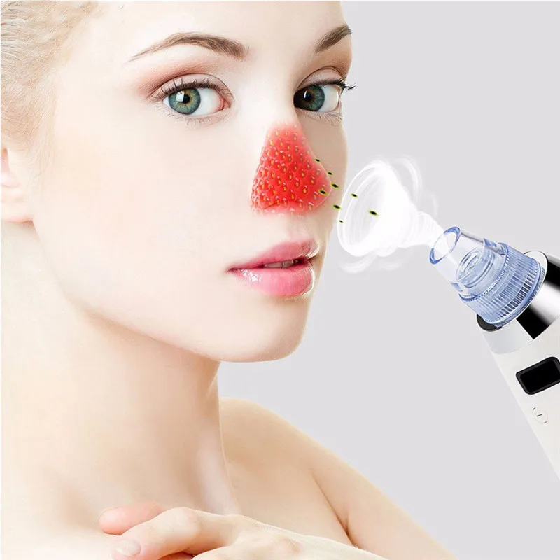 Вакуумный отсос для угрей Beauty Star устройство удаления очищение пор лица Комедо