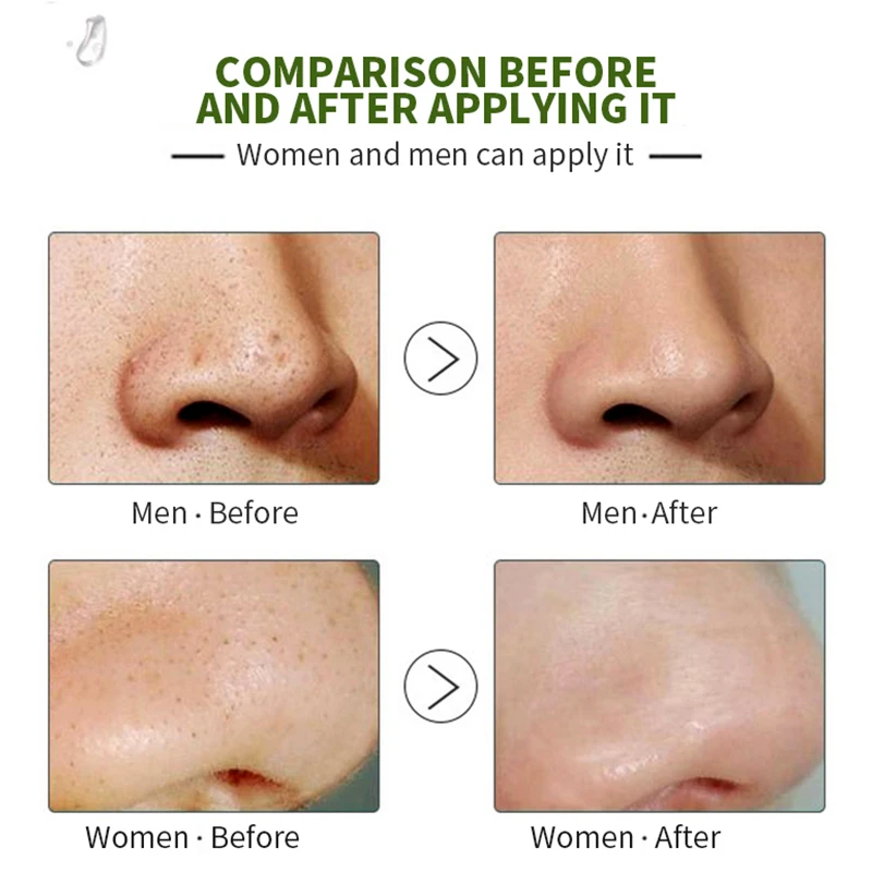 Сыворотка для лица BAOZOLAI с гиалуроновой кислотой жидким контролем жирности