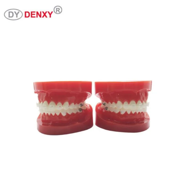 Denxy 1 шт. Стоматологическая модель с Ортодонтическая скобка исследование зубов Модель инструкция зубной ортодонтический керамический брекет Стоматологическая скоба