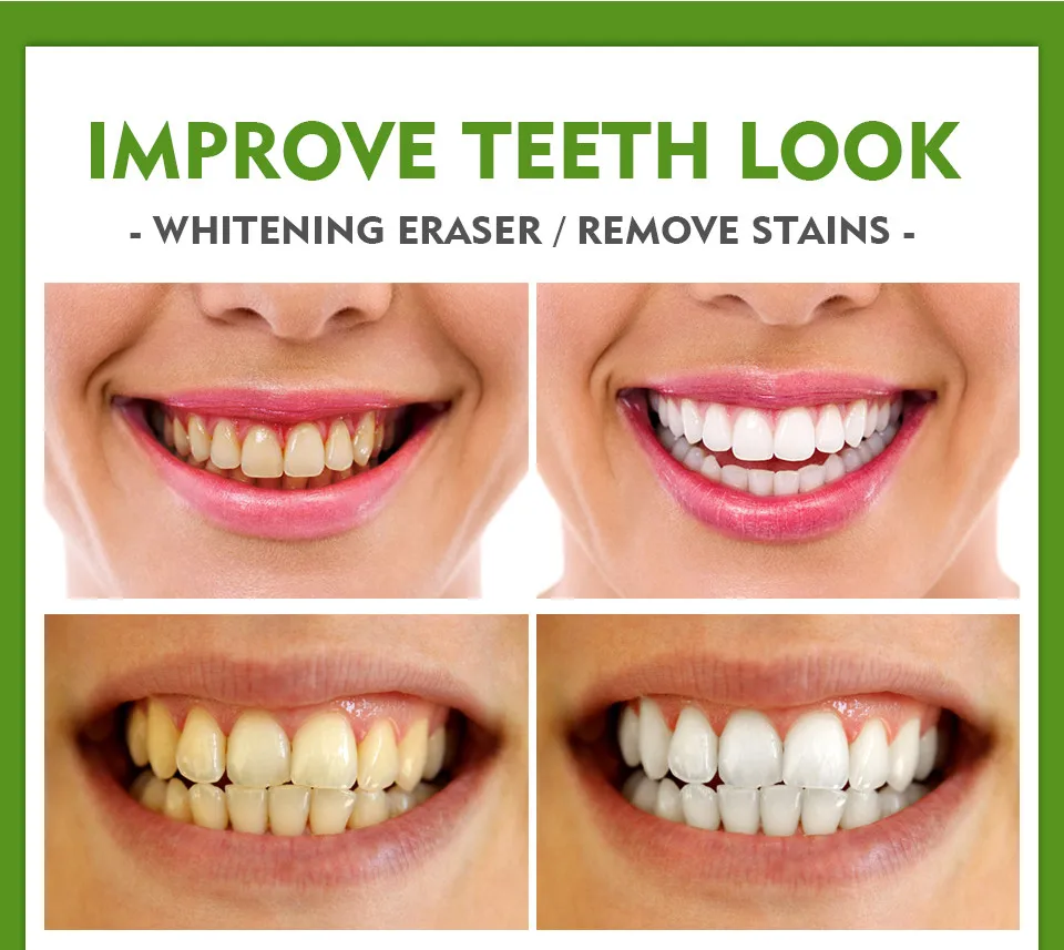 Белый для чистки зубов отбеливания стоматологические профессиональный комплект