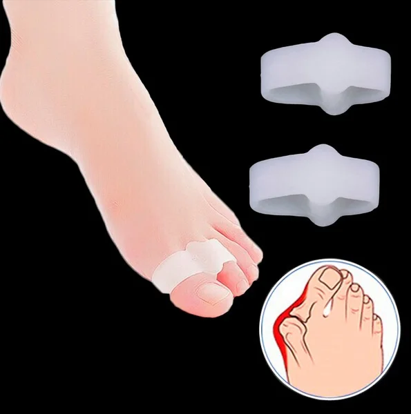 1 пара Выпрямители для ног при вальгусной деформации|bunion pain|hallux valgus supportbunion support |