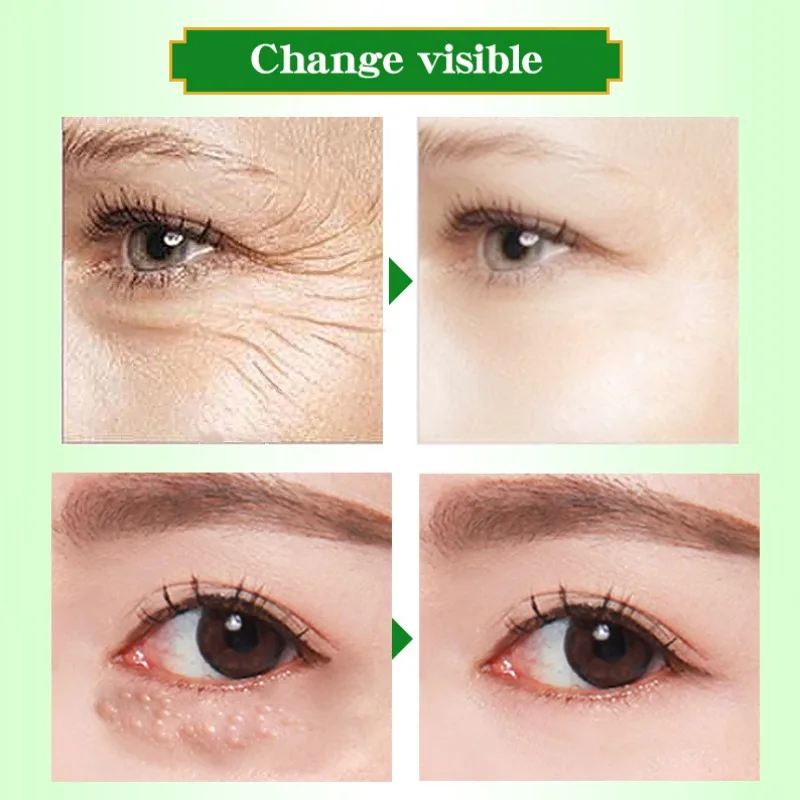 

Eye Cream Anti-Wrinkle Anti-aging Peptide Collagen Repair Remover Dark Circles Fat Granule Moisturizing Firming Eyes Skin