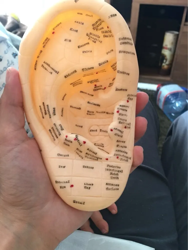 Ушные акупунктурные наушники модель для аурикулярной установки травм 17 см