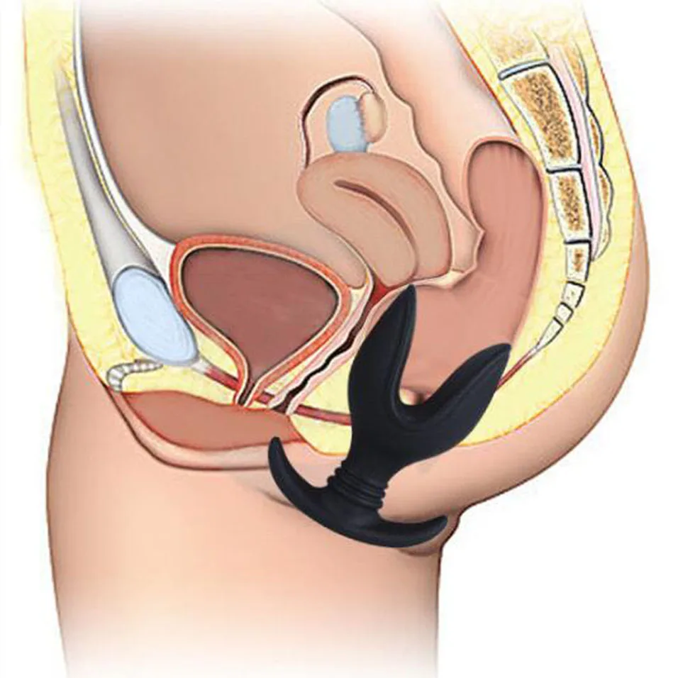 camaTech Soft Silicone V Port Anal Dilators Opening Butt Plug Speculum Prostate Massage Anus Expander Stimulator SM Erotic Toys | Красота и