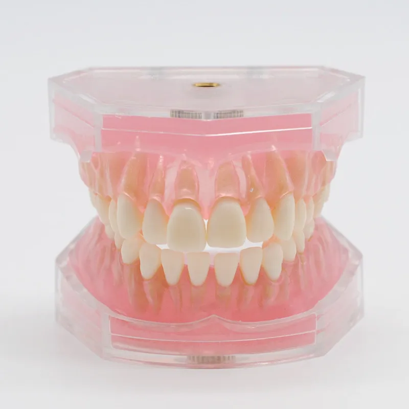 Стоматология лабораторная модель исследования зубов Overdenture Нижняя 4 имплантата