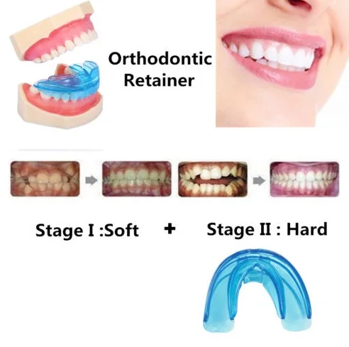 1 х софт и жесткие Ортодонтические зубные скобы фиксаторы фазы I + II | Красота