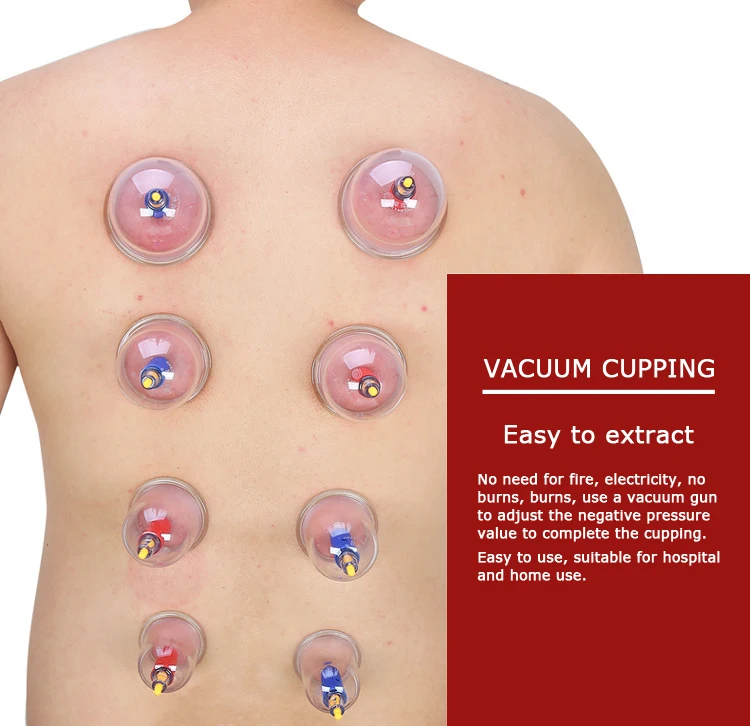 

24 Cans Cups Vacuum Cupping Set Magnetic Aspirating Cupping Cans Acupuncture Massage Suction Cup Chinese Medical Massage Kit