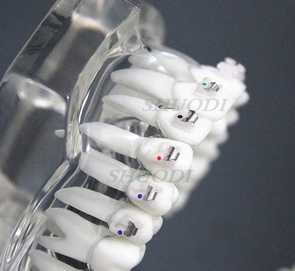 Стоматологическая Ортодонтическая модель для связи с пациентами 4 вида скоб