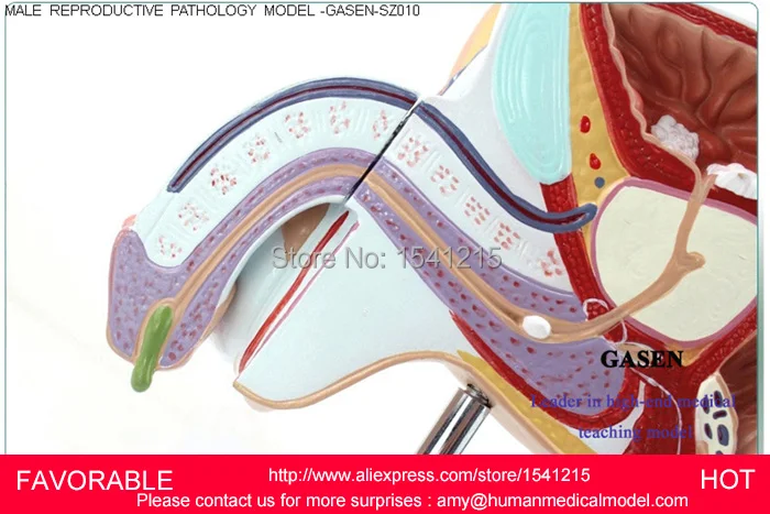 Модель мужской репродуктивной системы Анатомия продукт репродукции Мужской