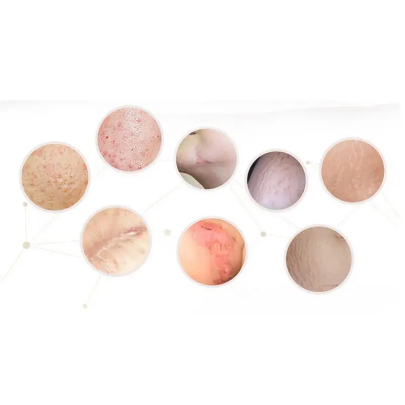 10 мл эссенция полного тела отбеливающая курица ремонт кожи эфирные масла удаляет