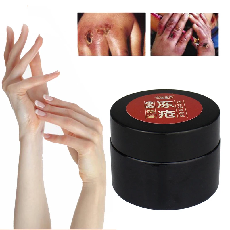 ZhanTing 3 Pcs / Horse Oil Foot Cream Anti-Chapping Skin Repairing Moisturizer For Rough Dry And Cracked Chapped Feet Heel | Красота и
