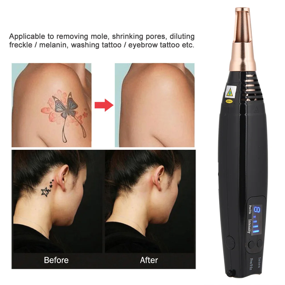 

Blu-ray/Red Light Picosecond Scar Tattoo Removal Laser Pen Freckle Acne Mole Dark Spot Pigment Tattoo Removal Beauty Machine