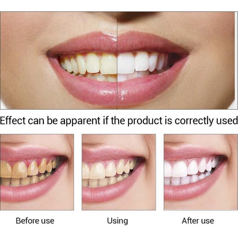 LANBENA отбеливание зубов эссенция гигиена полости рта натуральный растительный