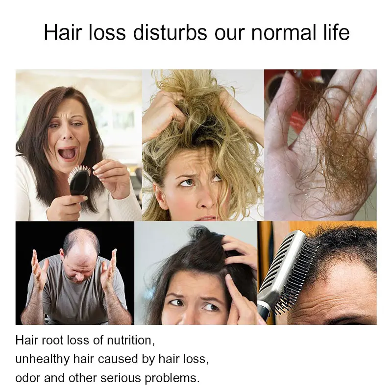 Шампунь против выпадения волос Sevich уход за волосами натуральный органический