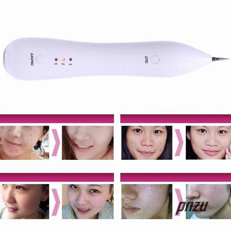 Новая горячая ручка для удаления кожных тегов Pro бородавок пигментные пятна