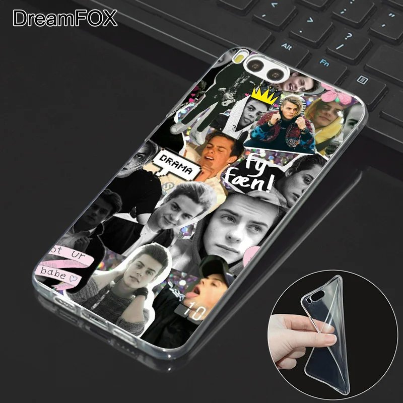 DREAMFOX M394 девушка Shawn Sherlocked Мягкий ТПУ силиконовый чехол для Xiaomi Mi Note 2 3 4 5 6 8 SE M5 4C 4S 5C