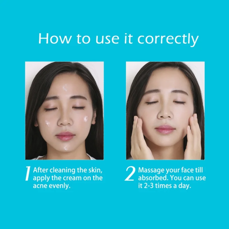 30 г маска &quotКрик&quot отбеливающий уход за кожей анти лечение акне крем для лица