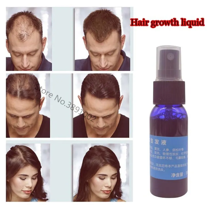 

New Brand Okeny's 2018 Yuda Pilatory Hair Growth Product Liquid Fast Hair Growth Hair Loss Treatment 30ml/bottle Anti Gray Hair