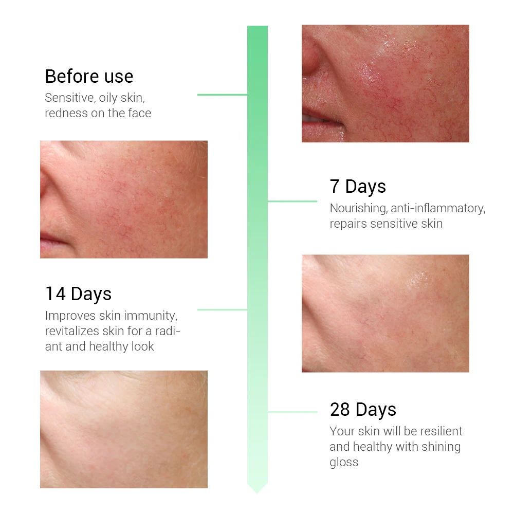 Сыворотка для лифтинга Retinol коллагеновая эссенция удаления морщин против