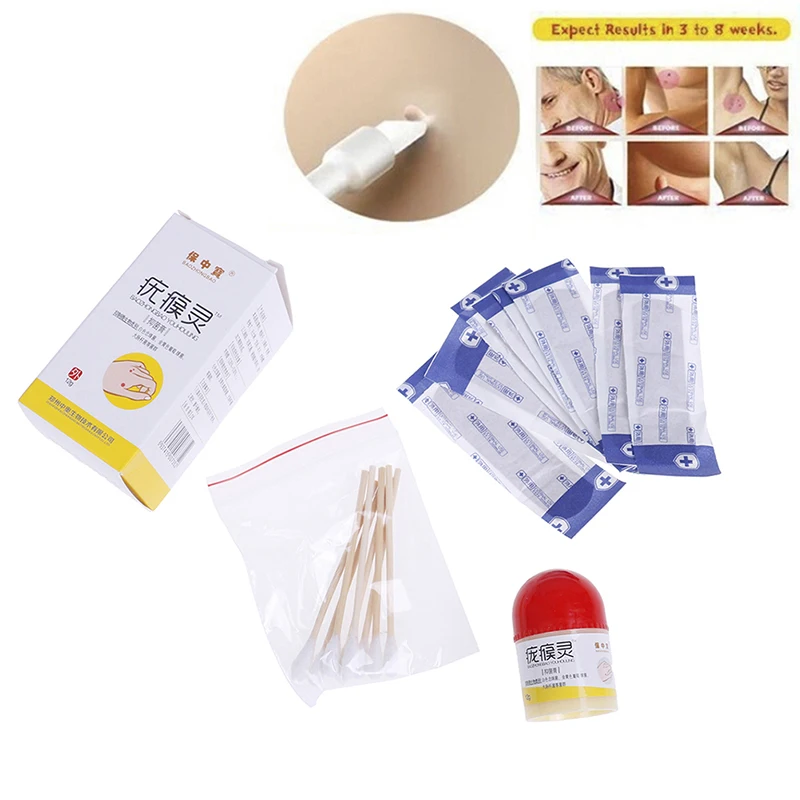 Remover Foot Corn Skin Tag Wart Removal Cream Tu Kill Medical Mole &amp Genital | Красота и здоровье