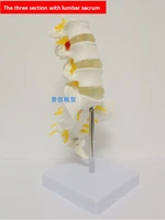free shippingthe lumbar vertebra model three lumbar vertebraes with sacrum model 11 natural sizefor medical teaching