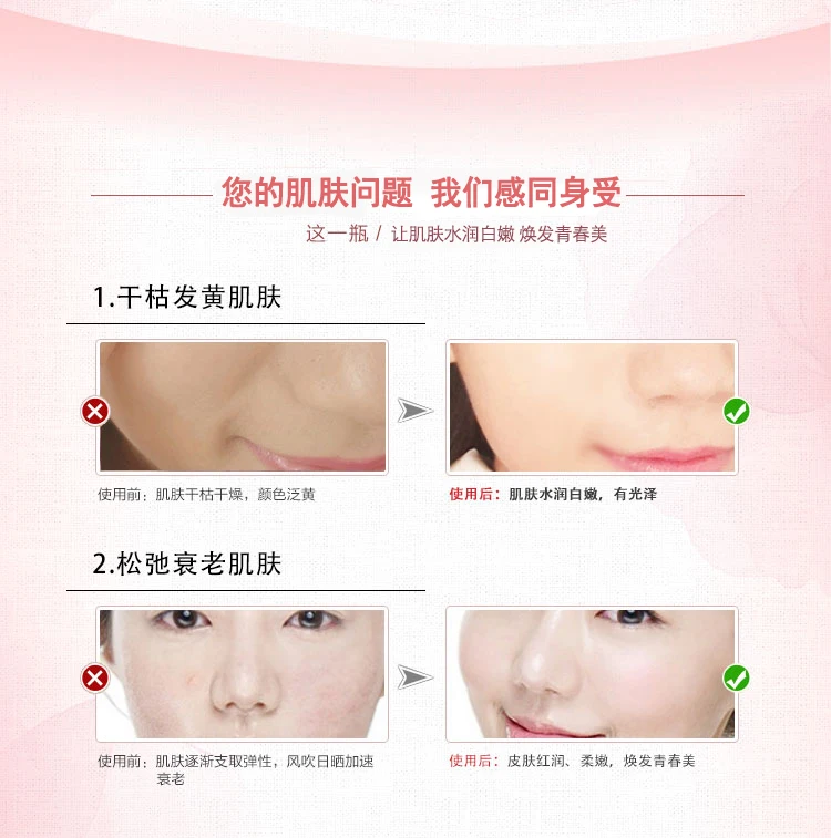 Original Zhangzhou litchi brand Pien Tze Huang Cream 30g pearl cream Hydrating Acne Blemish | Красота и здоровье