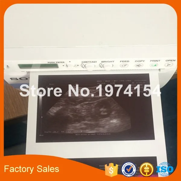 2X Rolls ultrasound UPP 110S 110mm*20m B-recorder UPP-110S thermal paper printer b-sheets A6 | Компьютеры и офис