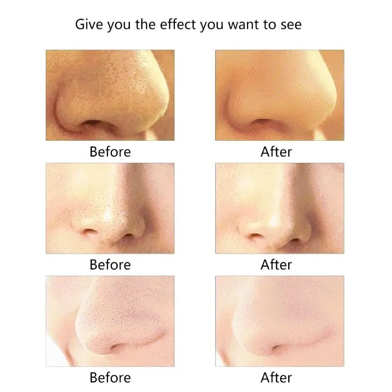 Электрический вакуумный пылесос для очистки лица удаление черных точек