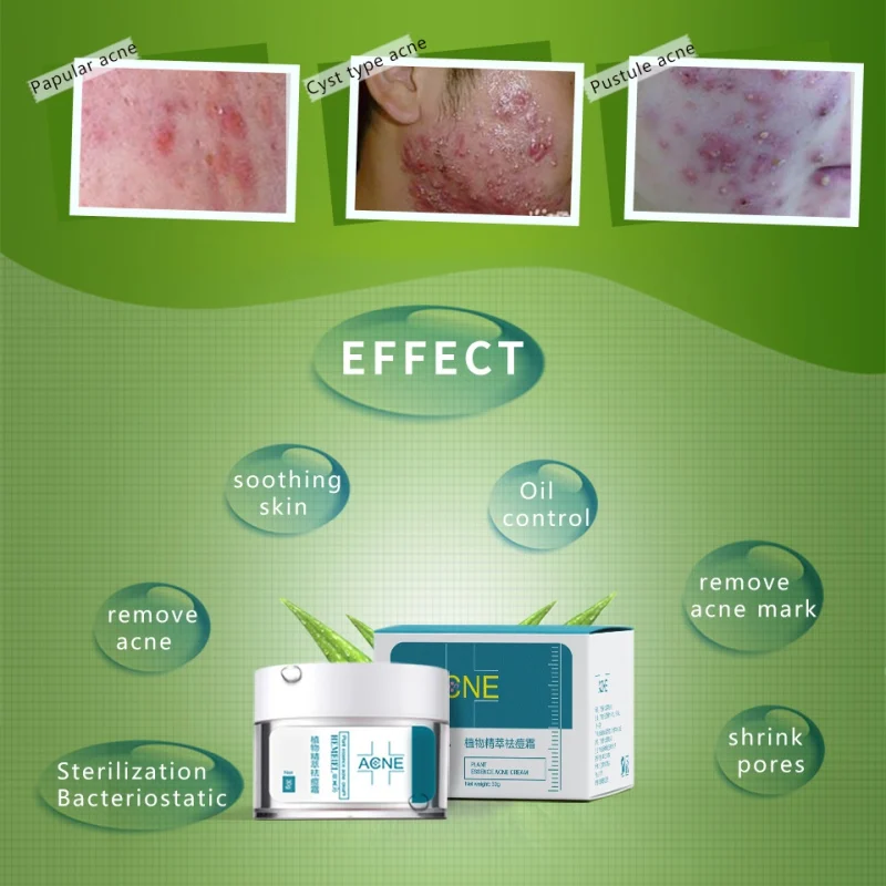 Новый увлажняющий крем для удаления прыщей и угрей отбеливающий контроль