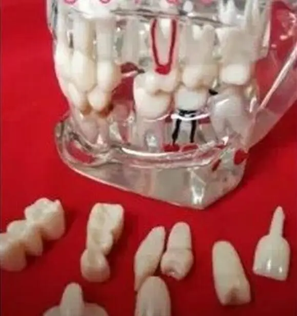 Модель зубов стоматологическая активность патологическая модель съемная