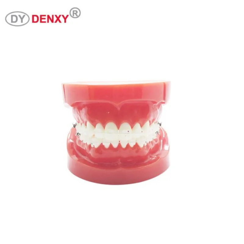 Denxy 1 шт. Стоматологическая модель с Ортодонтическая скобка исследование зубов Модель инструкция зубной ортодонтический керамический брекет Стоматологическая скоба