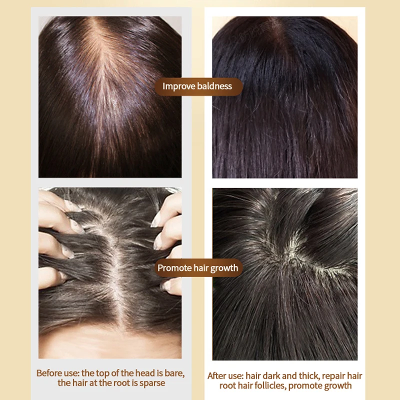 

7 Days Hair Care Fast Hair Growth Essential Oil Chinese Herbal Ginger Liquid Anti Hair Loss Dense Hairs Root Repair Treatment