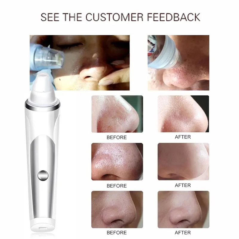 Черный очиститель для головы Быстрый АБС массаж эффективный уход за кожей белый