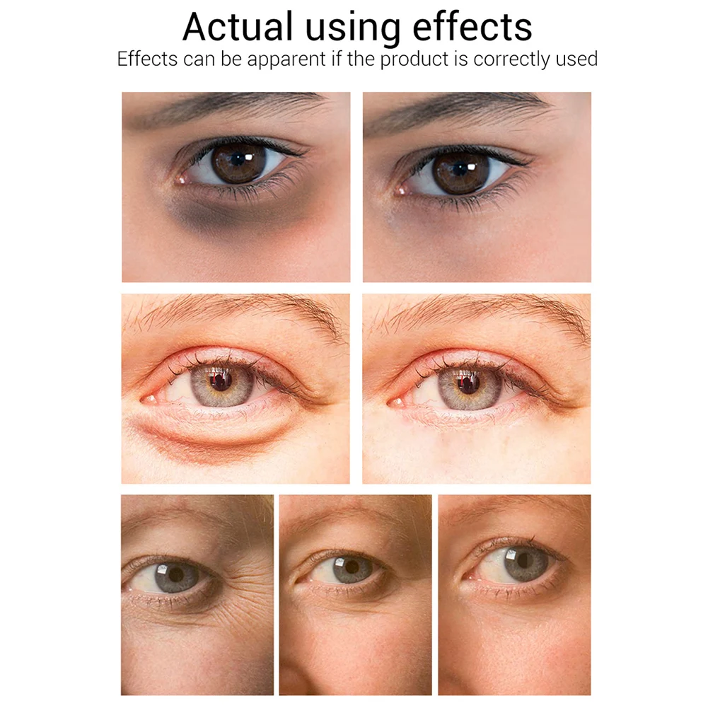 Женский отбеливающий крем LANBENA удаляет темные круги мешки для глаз устраняет