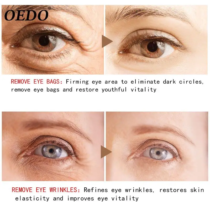 Гиалуроновая кислота женьшень отлично конденсата для ухода за областью вокруг