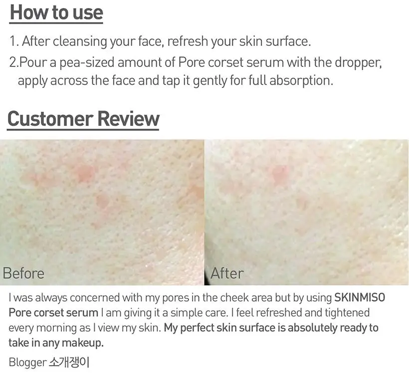 Корсет для пор SKINMISO сыворотка сужения 30 мл очищение контроль кожного сала