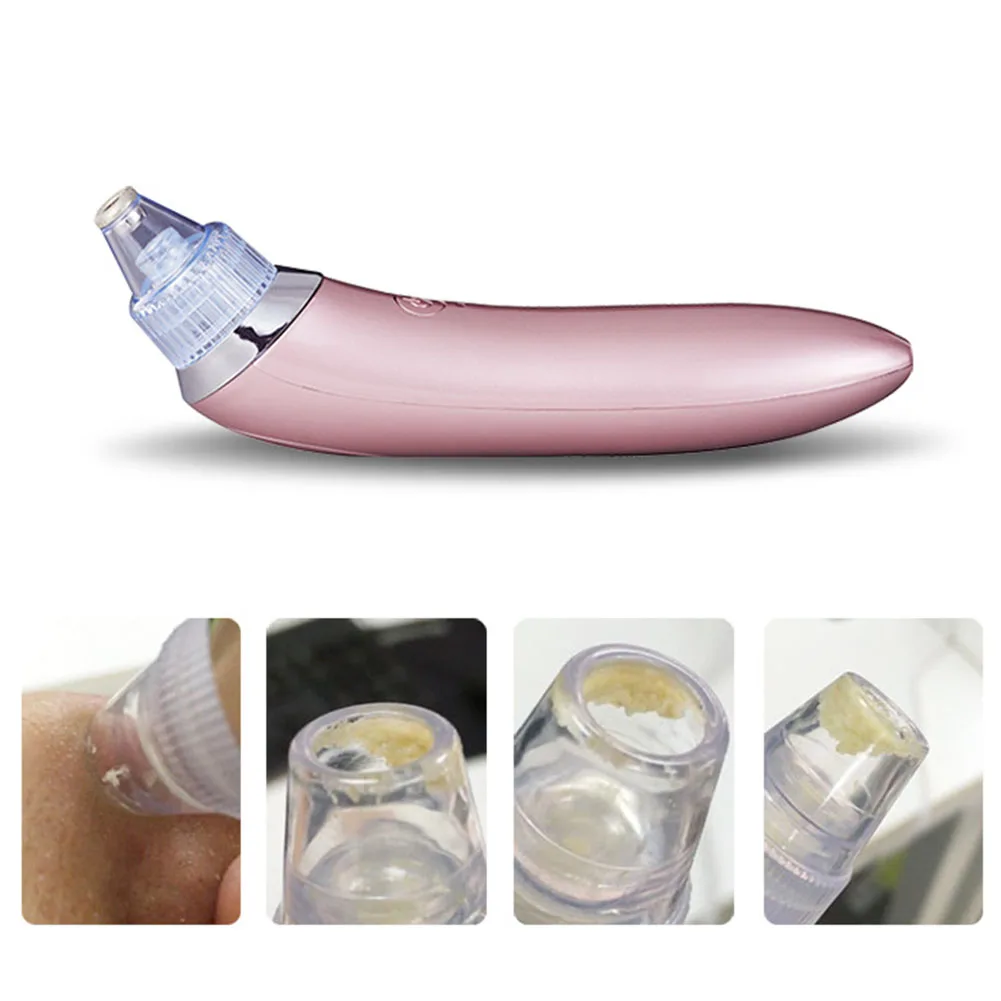 Вакуумный всасывающий пор пылесос Электрический акне Очистка Отшелушивающая