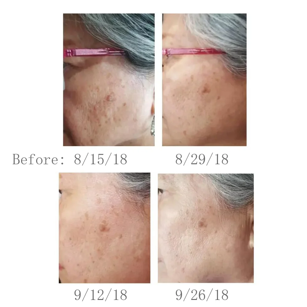 Осветительная лампа Bittb с красным светодиодом для терапии коллагеном