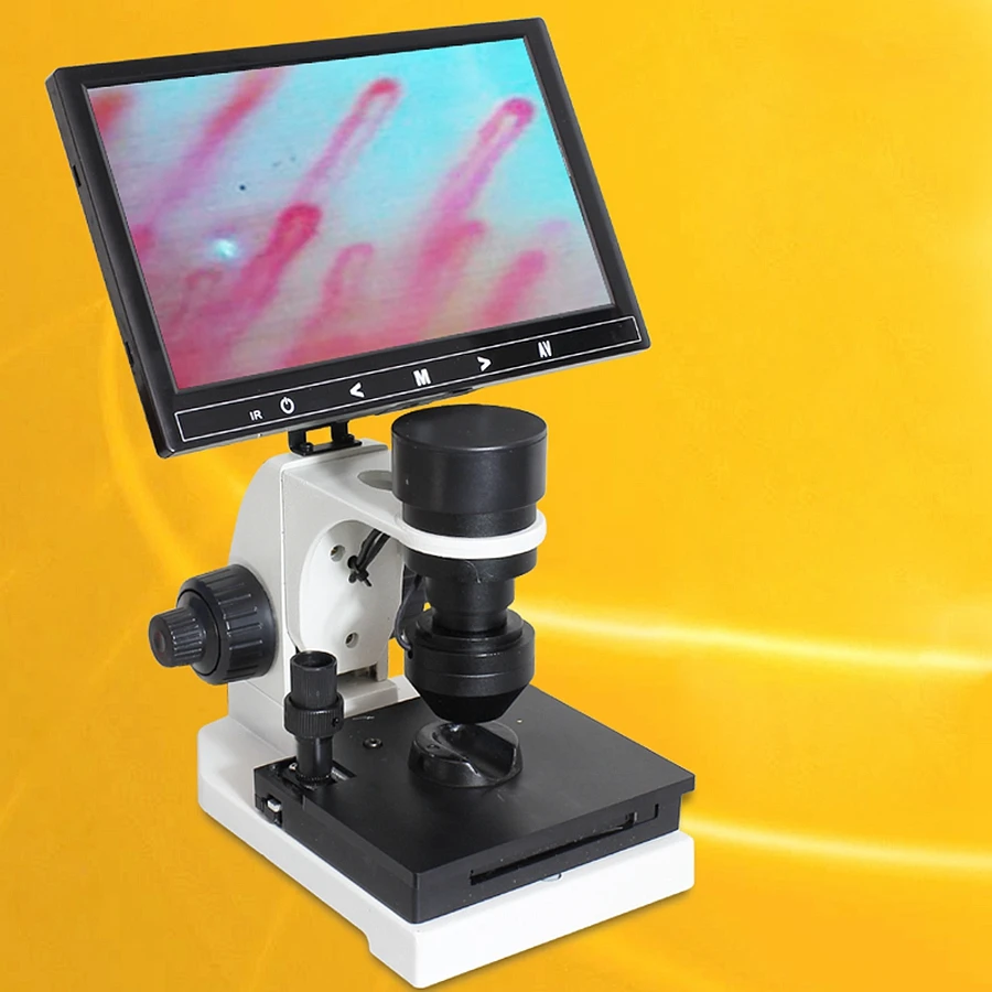 

Electronic Microcirculation Detector Peripheral Vessel of Nail Wall Observer Digital Microscope with 7"/8"/9" LCD Displayer