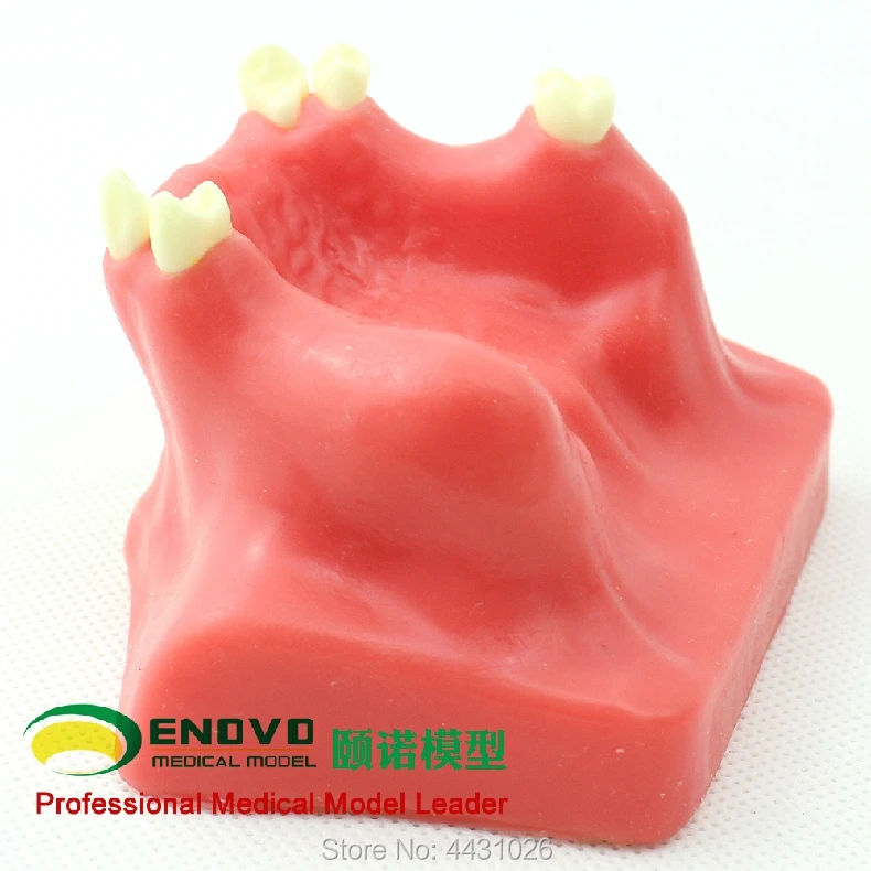 

ENOVO Dental implant training on maxillary sinus augmentation of maxillary sinus