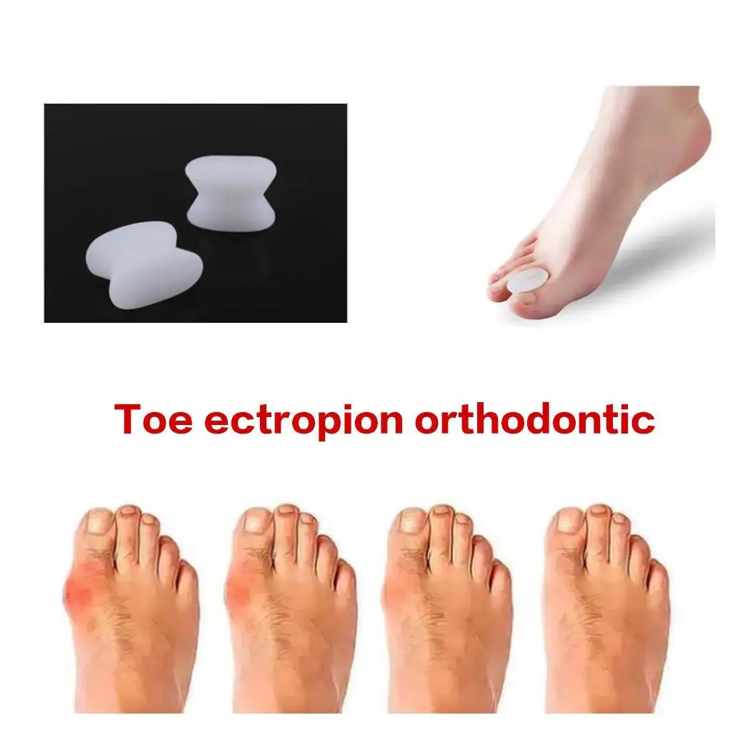 Силиконовый большой палец Eversion Bigfoot Bone перекрывает белый телесный коррекционный