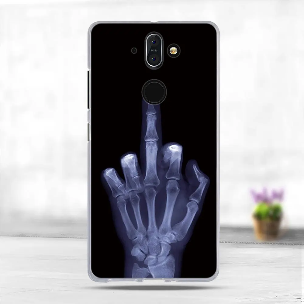 Чехол для телефона Nokia 8 Sirocco ультра тонкая Мягкая силиконовая задняя накладка из