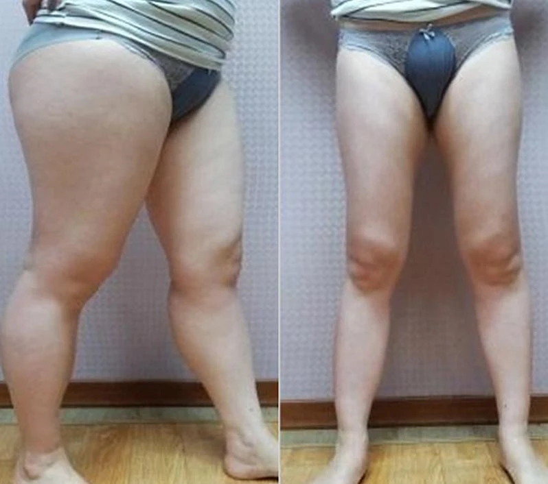 L-carnitine tea стикер для женщин и мужчин наклейка для похудения патч потеря веса тела продукты высокого качества измеритель тела