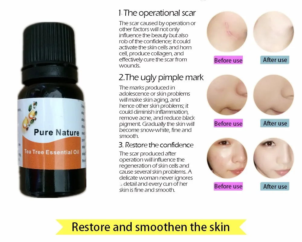 

MIYUELENI Natural Tea plant Remove Wrinkle Essential Oil Deep Moisturizing Acne Treatment Significant effect