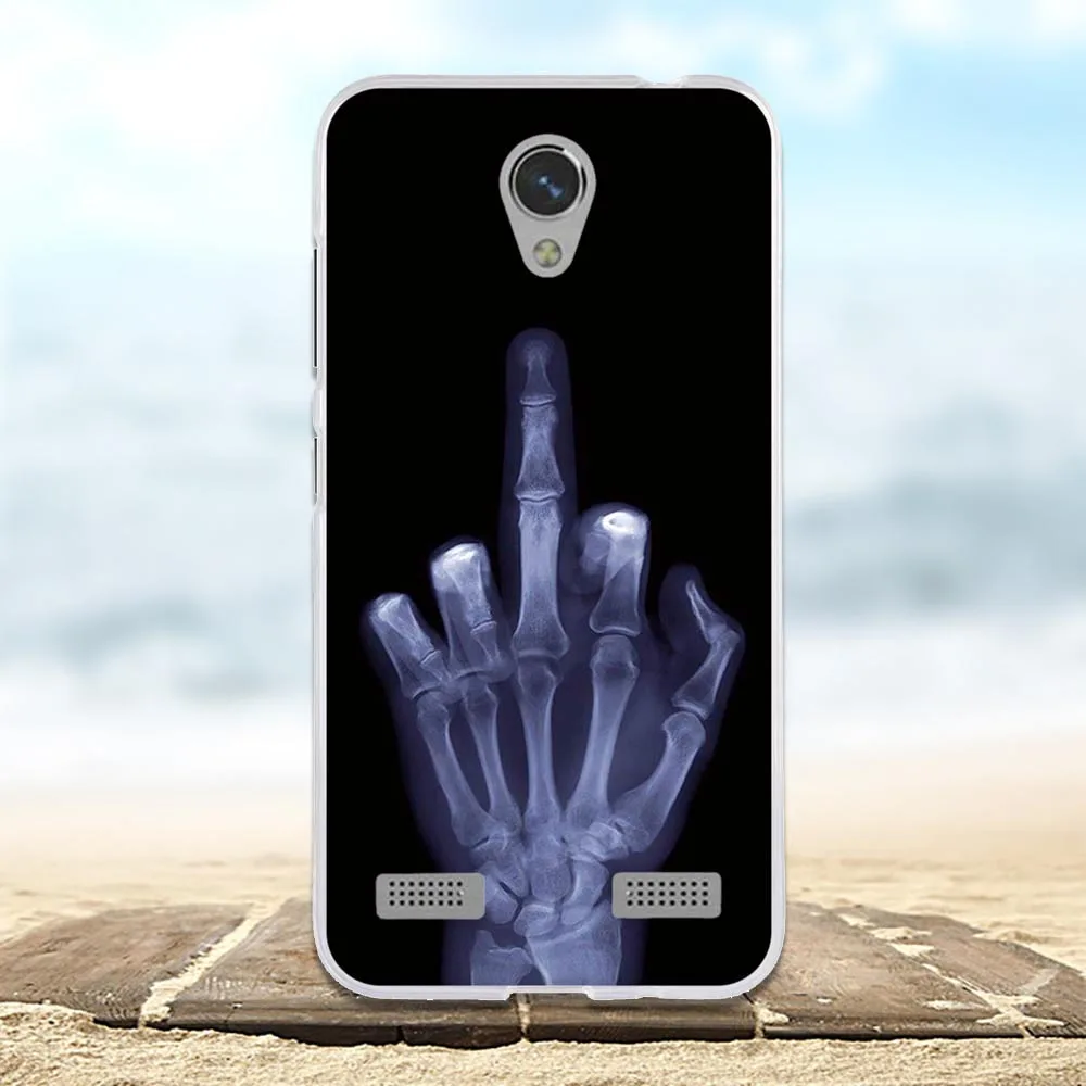 Чехол для zte Blade A520 BA520, мягкий силиконовый чехол из ТПУ, задняя крышка 5,0 дюйма для zte A520, чехол для телефона s, 3D милый чехол с цветочным рисунком
