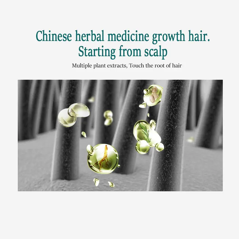 Эссенция для роста волос ARTISCARE уход за волосами мужчин и женщин лечение выпадения