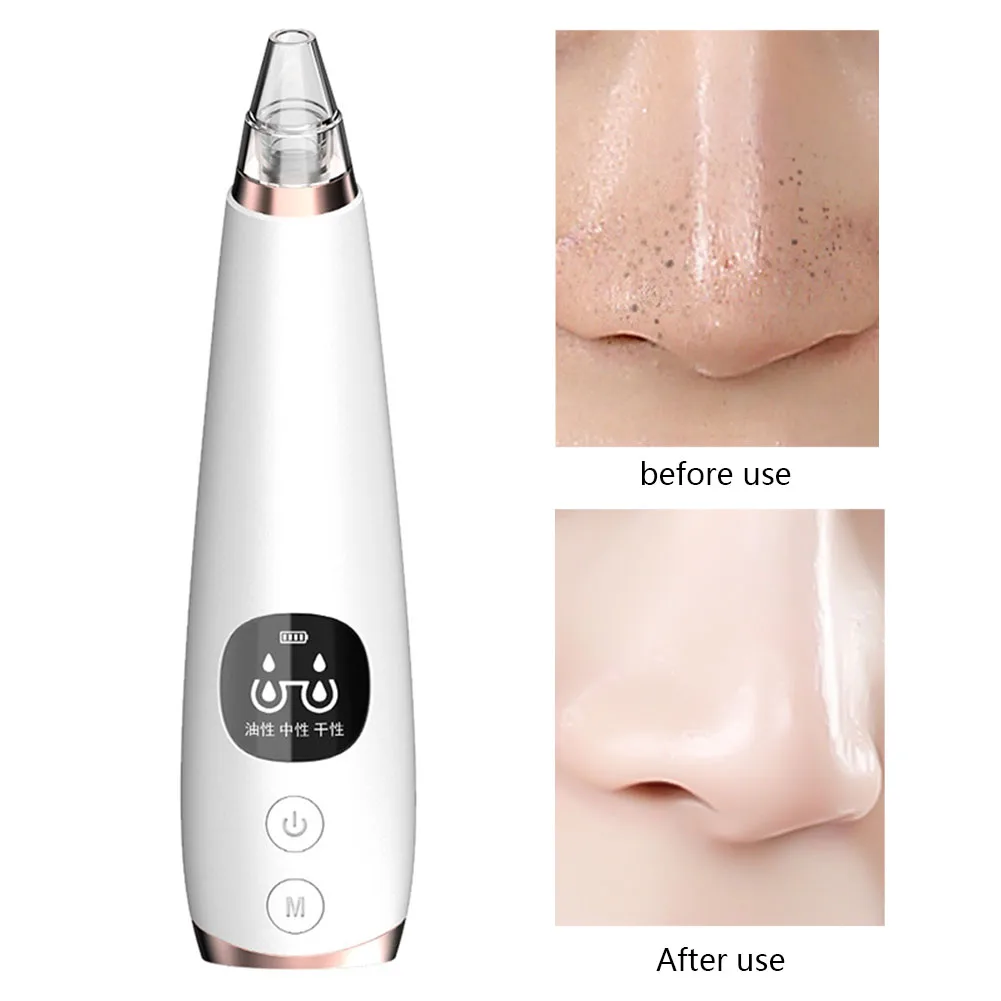 Набор косметических инструментов для удаления черных точек оборудование