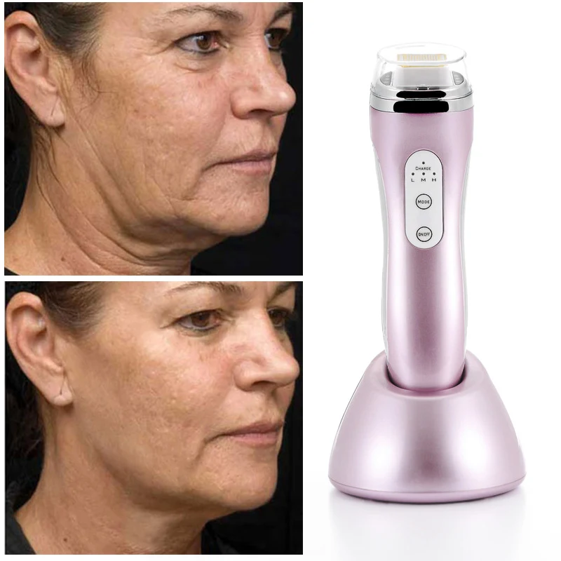 Радиочастота RF удаление морщин для лица против старения подтяжка кожи массаж