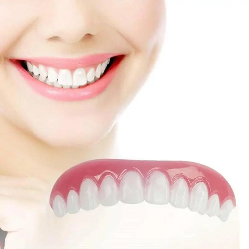 Smile комфорт верхние зубы шпон косметический | Красота и здоровье