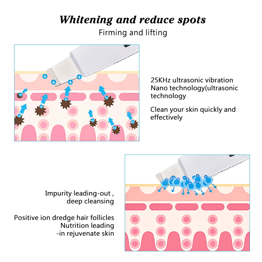 Ультразвуковой очиститель кожи лица отшелушивающее Удаление пор уход за кожей